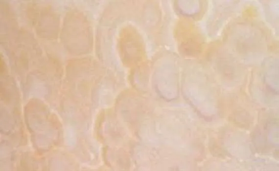 Aranca Onyx aranca 6622
