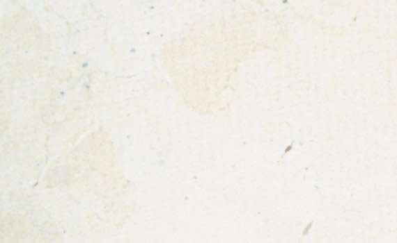 palmyra stone 1591