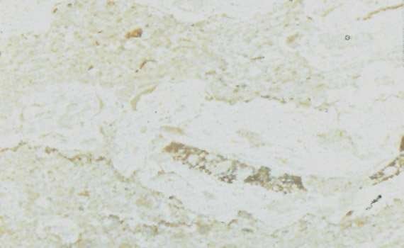 perlato royal 1594